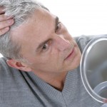 protesi capelli su misura