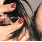 calco per protesi di capelli