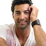 centro capelli novara, protesi capelli, impianto capelli novara