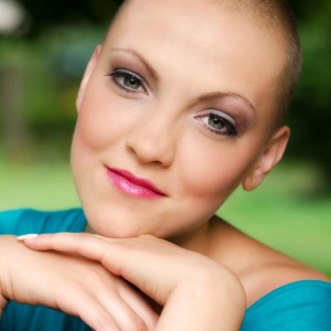Alopecia globale Alopecia globale
