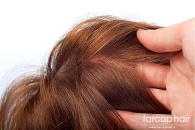 protesi capelli gradual